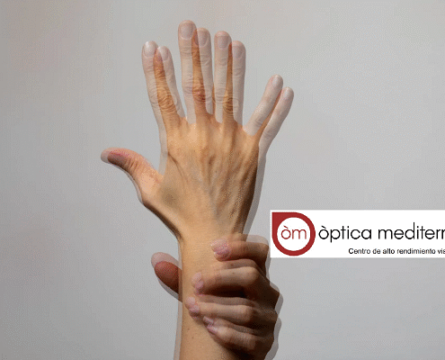 una mano distorsionada por culpa de la vision doble o displopía