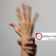 una mano distorsionada por culpa de la vision doble o displopía